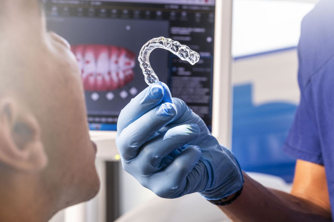 Un allineatore trasparente davanti alla scansione dei denti